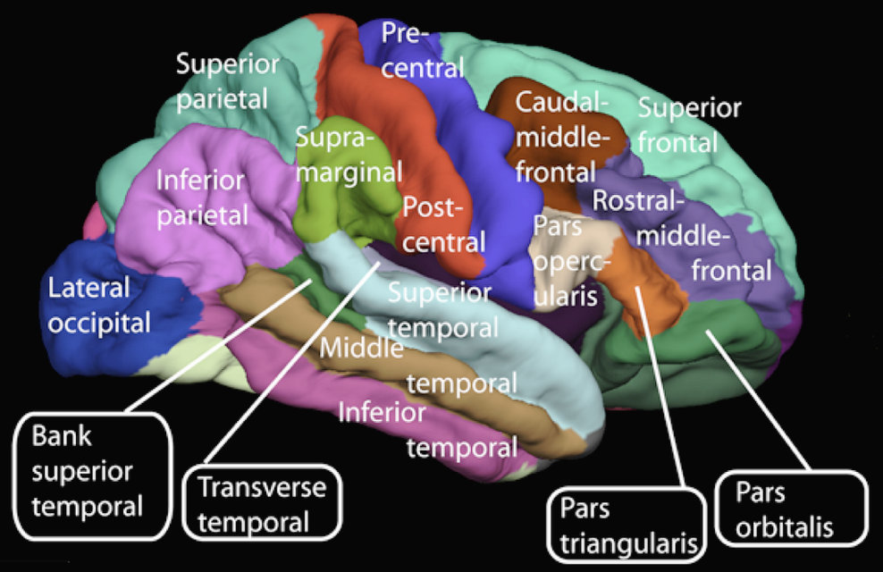 Cerebral achromatopsia