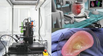 Bioimpresión 3D